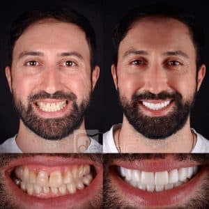 An image showcasing the transformation of a smile through orthodontic treatment.
