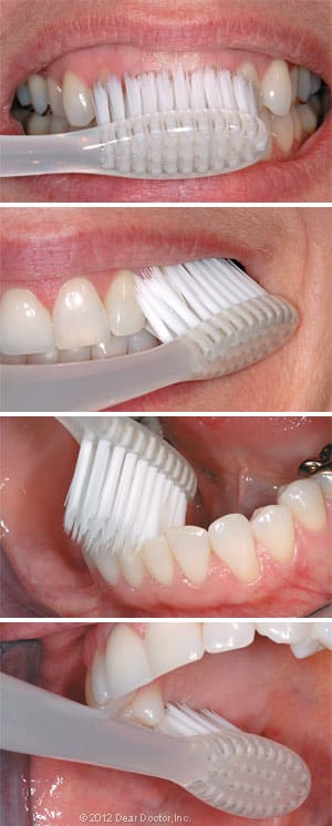 Illustration of the proper teeth brushing technique for optimal oral health