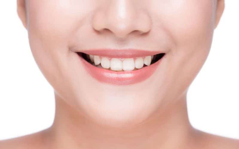 Different teeth whitening products displayed on a bright background