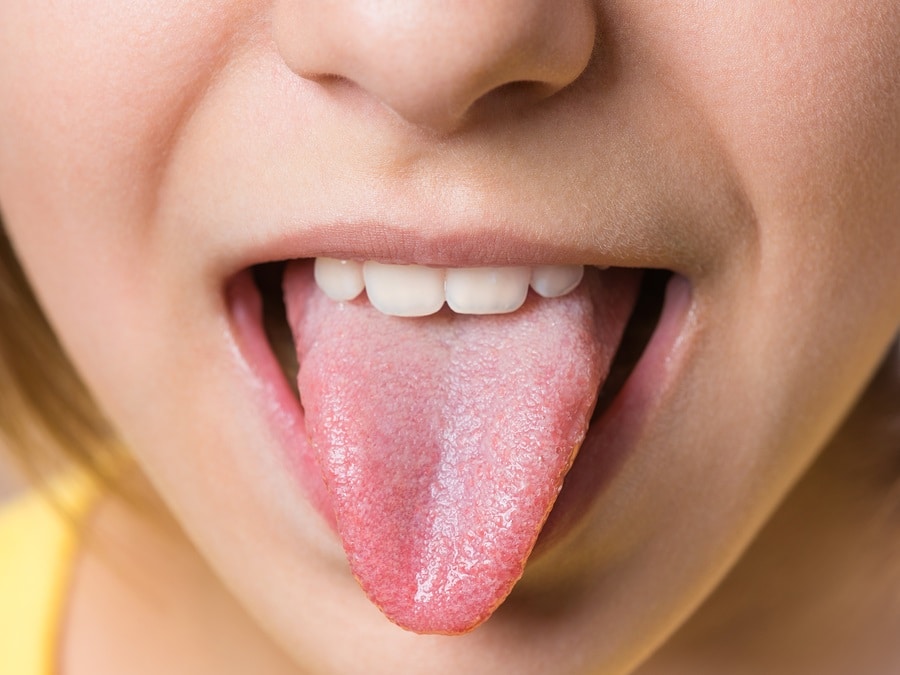 A close-up image of a healthy tongue, highlighting the importance of tongue care in Decatur, GA.