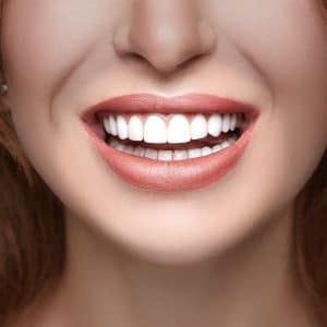 A comparison of porcelain and composite veneers for a stunning smile makeover.