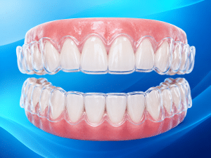 Invisalign