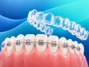 Orthodontics & Braces